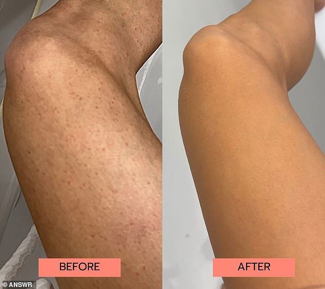 SUMMER PROMOTION - Smoothing Solution Ingrown Hair Treatment