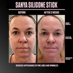 Sanya Scar Stick Treatment Solution