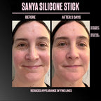 Sanya Scar Stick Treatment Solution