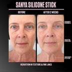 Sanya Scar Stick Treatment Solution
