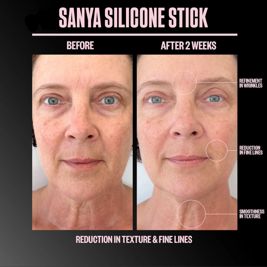 Sanya Scar Stick Treatment Solution