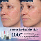 5-step Korean Skincare Set