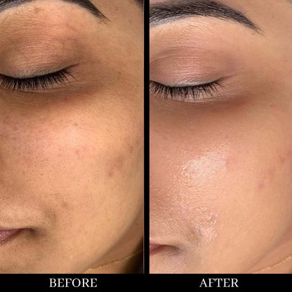 BUY 1 GET 1 FREE Vitamin C Serum lines & wrinkles & delicate skin